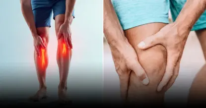 Названы опасные осложнения варикозного расширения вен: что нужно знать