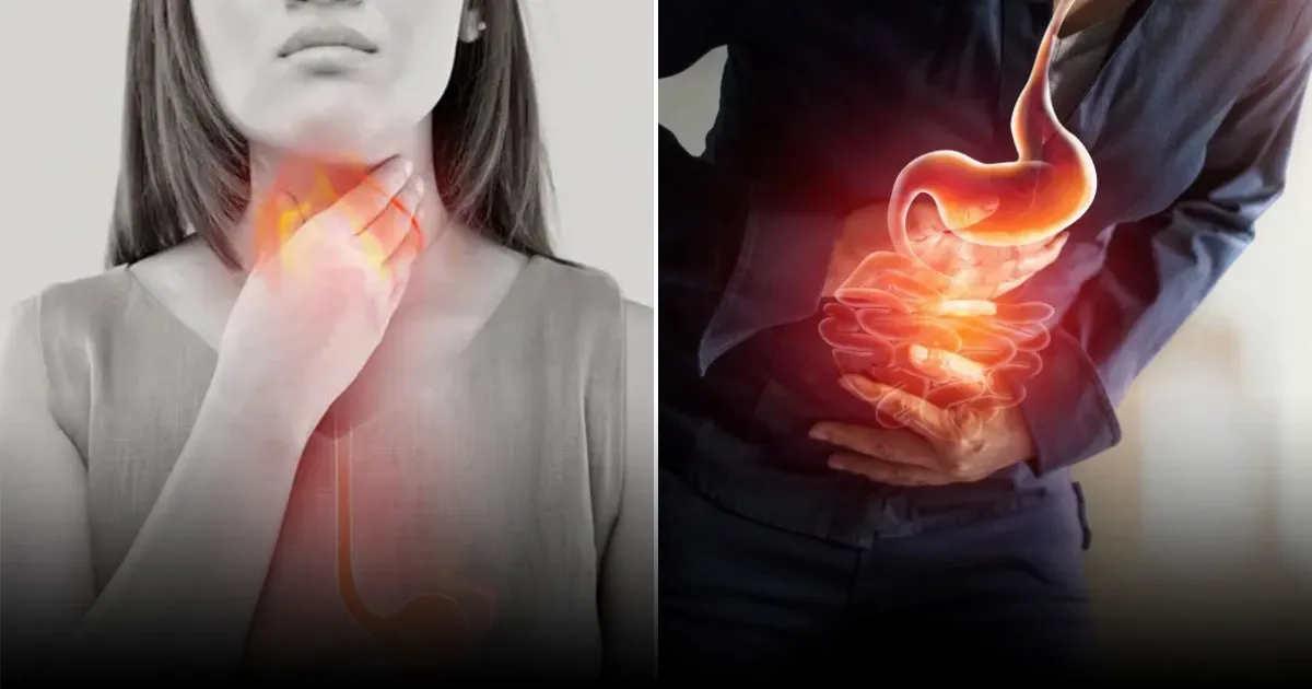 Гастроэнтеролог дала советы по эффективному лечению изжоги Гастроэнтеролог дала советы по эффективному лечению изжоги