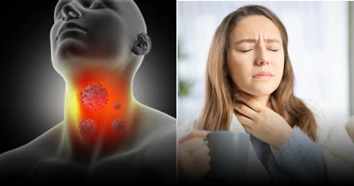 Россиянам дали рекомендации по лечению горла в домашних условиях Россиянам дали рекомендации по лечению горла в домашних условиях