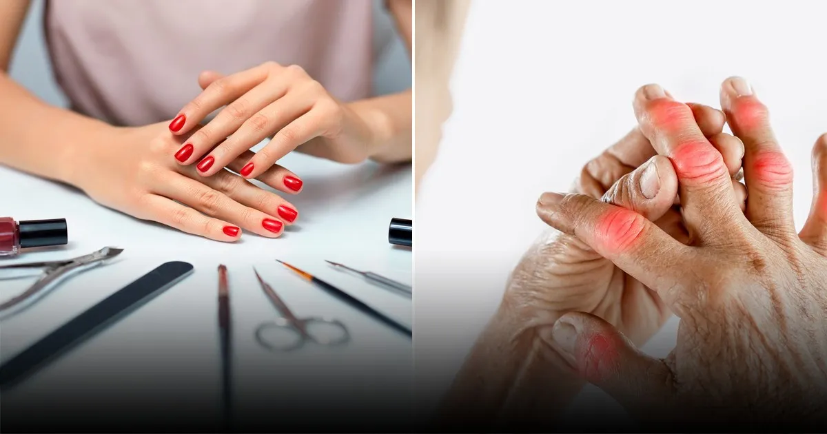 О внешних признаках здоровья: что могут рассказать ногти